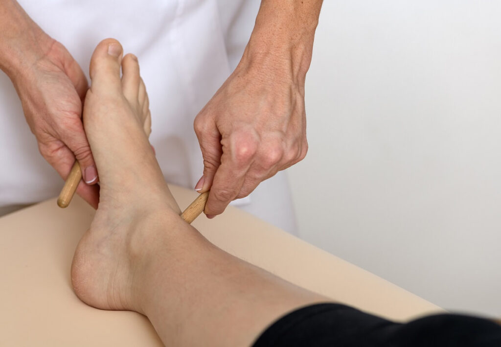 Acupressure | Shraddha Physiotherapy Clinic - Best Physiotherapy in Ahmedabad