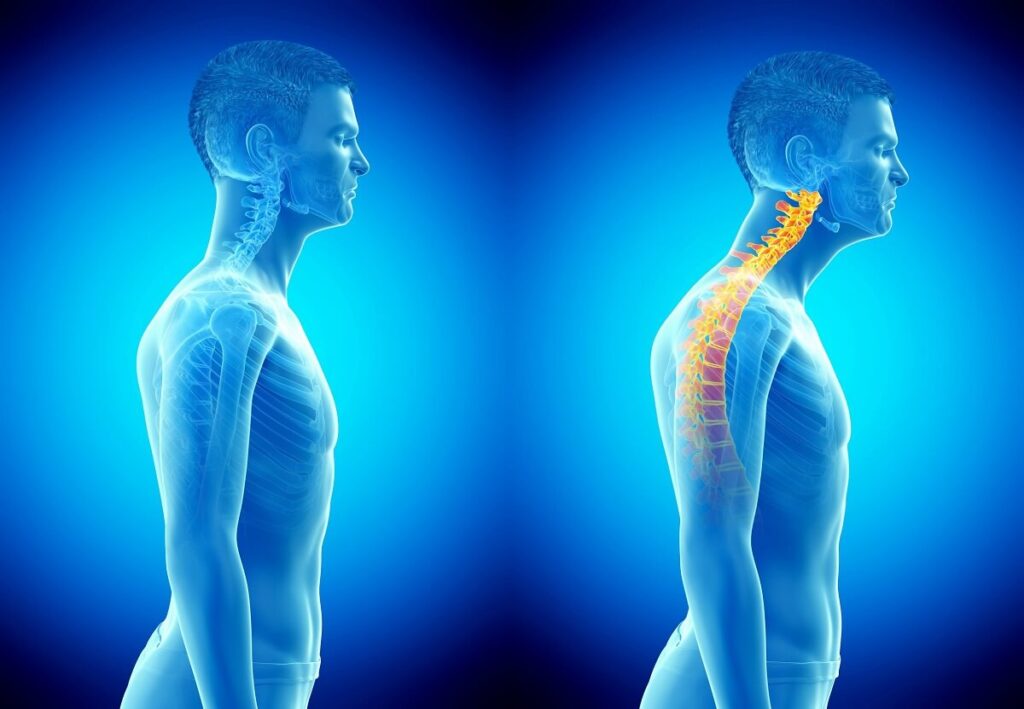 Human Body Alignment | Shraddha Physiotherapy Clinic - Best Physiotherapy in Ahmedabad
